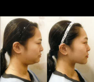 _ĘͳCСĘƤwpɸ㶨